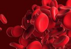Preventing bleeds before they happen: understanding prophylaxis in haemophilia care